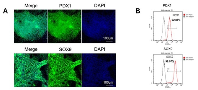 Step 2 – iPSC to pancreatic endoderm differentiation.