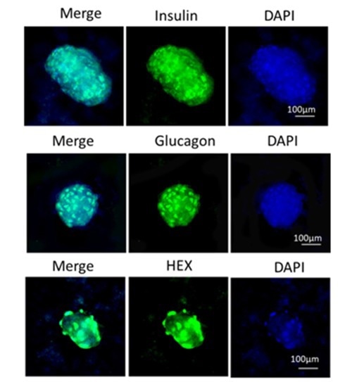 Step 3 – iPSC to mature pancreatic cell differentiation.