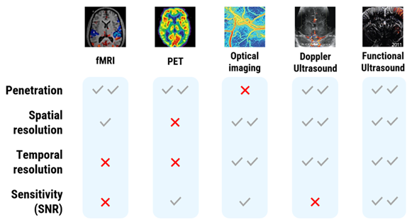 Whole brain network imaging using functional ultrasound (fUS)