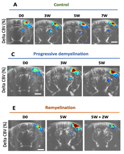 Whole brain network imaging using functional ultrasound (fUS)