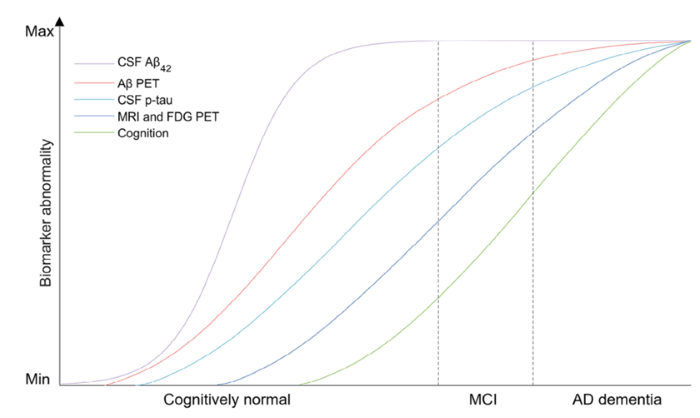 Immunoprecipitation-enhanced blood-based biomarkers for early diagnosis of Alzheimer’s disease