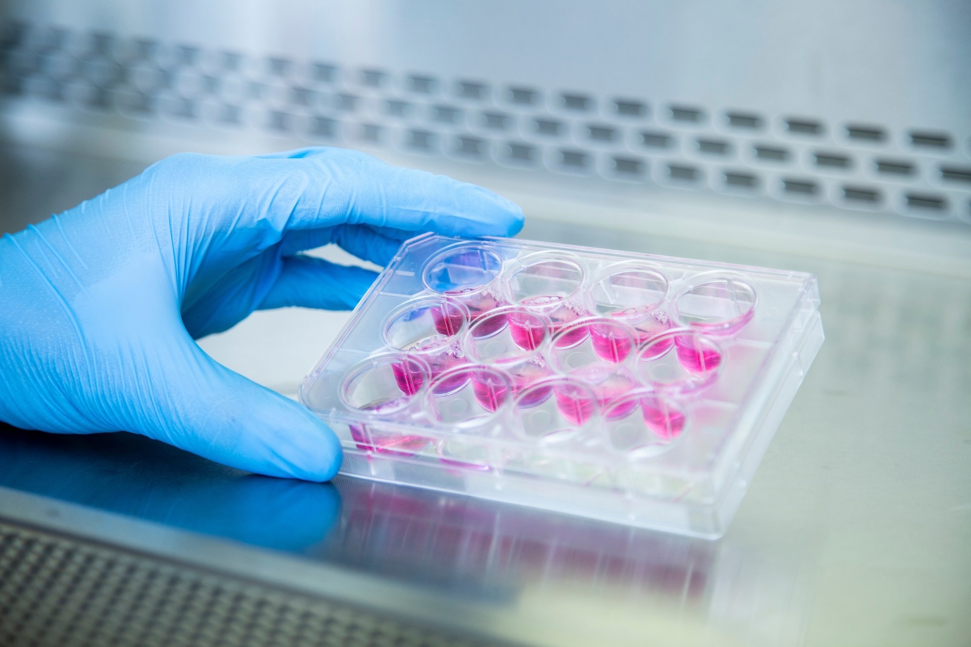 Image Credit: OMER FARUK ERCEYLAN/Shutterstock.com