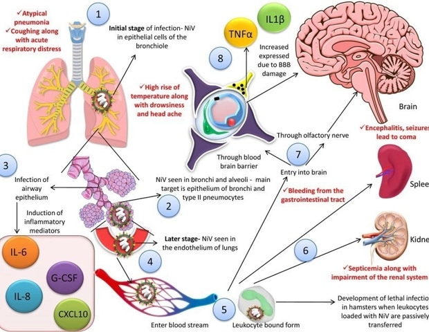 What is Nipah virus and why does it have a 75 % fatality rate?