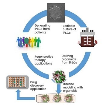 Workflow of patient-derived iPSCs