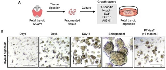 Generation of reproducible human fetal thyroid organoids (hFTOs)