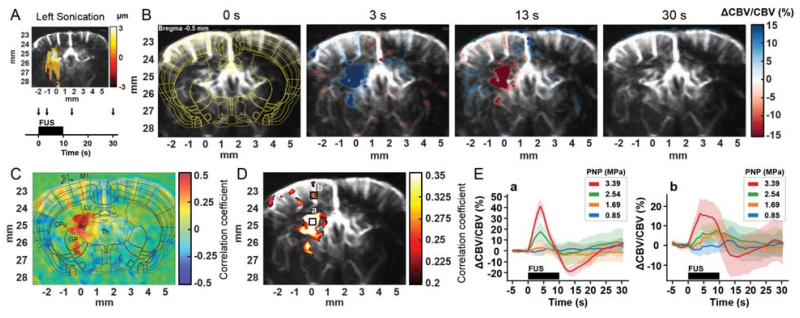 Functional responses to focused ultrasound stimulation. Functional ultrasound (fUS) imaging reveals that focused ultrasound (FUS) induces measurable hemodynamic responses in the brain. (A) Experimental setup showing targeting and stimulation timeline. (B) Representative blood volume changes at different time points following stimulation. (C–D) Activation maps highlighting regions responding to the stimulus. (E) Quantification of the response amplitude under different stimulation intensities, shown as mean ± standard deviation. Figure reproduced without modification