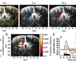 Functional ultrasound (fUS) vs. focused ultrasound (FUS) for brain activity mapping