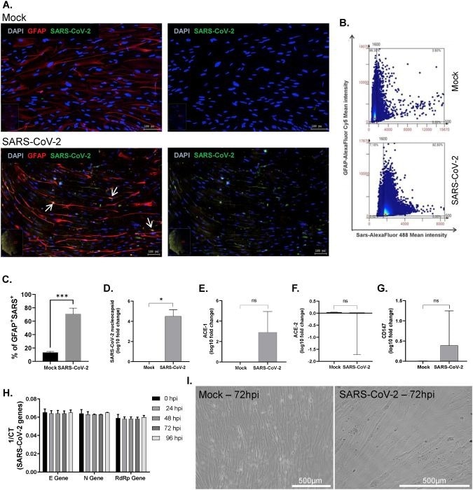 SARS-CoV-2 gliotropism on cortical astrocytes derived from hiPSCs