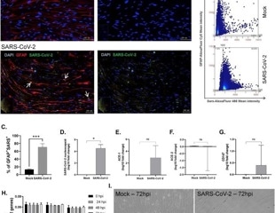 How SARS-CoV-2 impacts astrocyte function in neurocovid-19