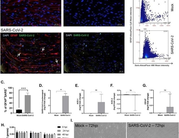 How SARS-CoV-2 impacts astrocyte function in neurocovid-19