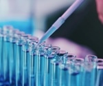 High-throughput chromatography in bioprocess analytics
