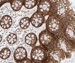 IHC workflow: Tips and tricks