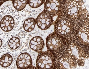 IHC workflow: Tips and tricks