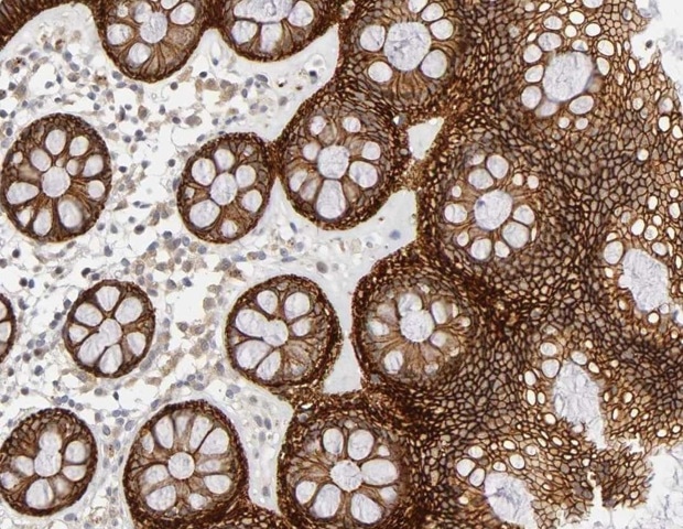 IHC workflow: Tips and tricks