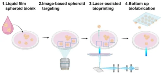 Spheroid laser-assisted bioprinting: Cell spheroids are imaged, targeted, and transferred by the laser to form a predesigned pattern