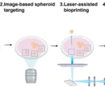 Bioprinting 3D multicellular cartilage spheroids by laser
