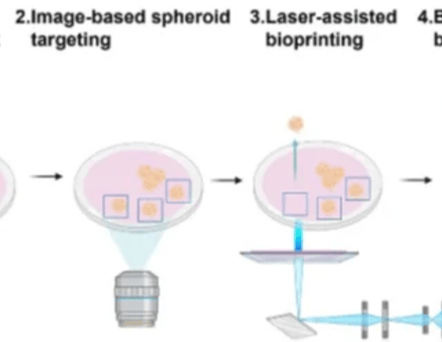 Bioprinting 3D multicellular cartilage spheroids by laser