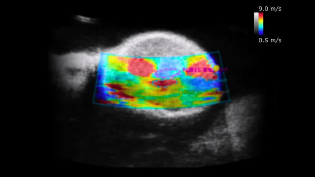 Clinical vs. preclinical ultrasound: Frequency effects