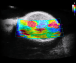 Clinical vs. preclinical ultrasound: Frequency effects