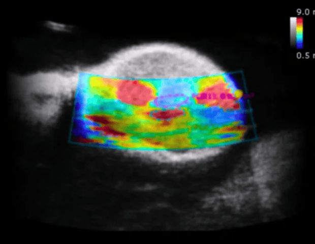 Clinical vs. preclinical ultrasound: Frequency effects