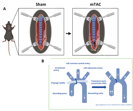 TAC Procedure. A) A schematic showing the novel approach of the TAC procedure from the neck-chest rather than a partial thoracotomy as in conventional TAC procedures. The suture is tightened around the aortic arch. B) Arrows showing the changes in blood flow velocity in specific vessels before and after the TAC procedure. This change in hemodynamics creates cardiac pressure overload.
