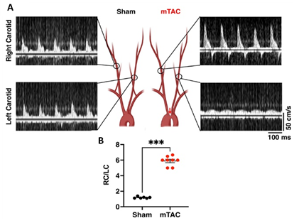 TAC Stratification Imaging in SHAM and TAC mice. A) Schematic illustration of the aortic arch with no ligation (sham; left panel) and ligation (mTAC; right panel), and representative recording patterns of blood flow in the right carotid and left carotid. B) Quantification of RC/LC (right carotid to left carotid) ratios in sham (n = 6) versus mTAC (n = 8) mice. Highlighting the RC/LC ratio as a reproducible verification of successful TAC surgery. Data shown mean ± SEM. ***P < 0.001 using student’s t-test.