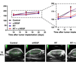 Non-invasive imaging of tumor vascular response