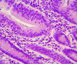 Why staining matters in pathology microscopy