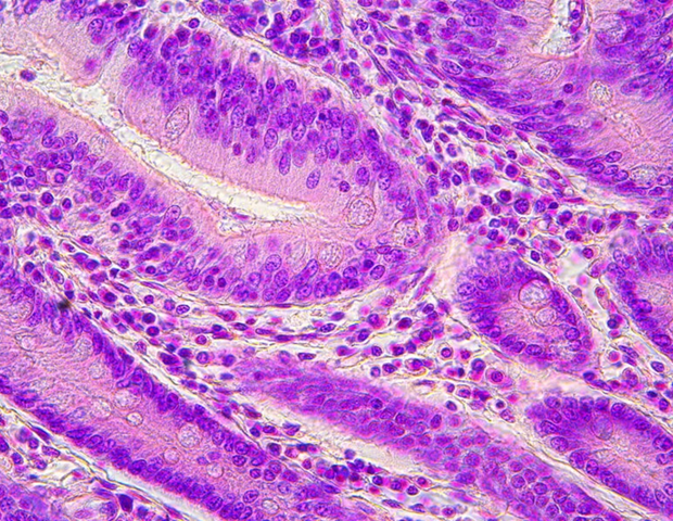 Why staining matters in pathology microscopy