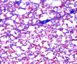 Choosing the right camera for clinical microscopy