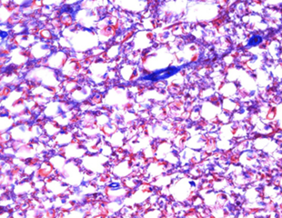 Choosing the right camera for clinical microscopy