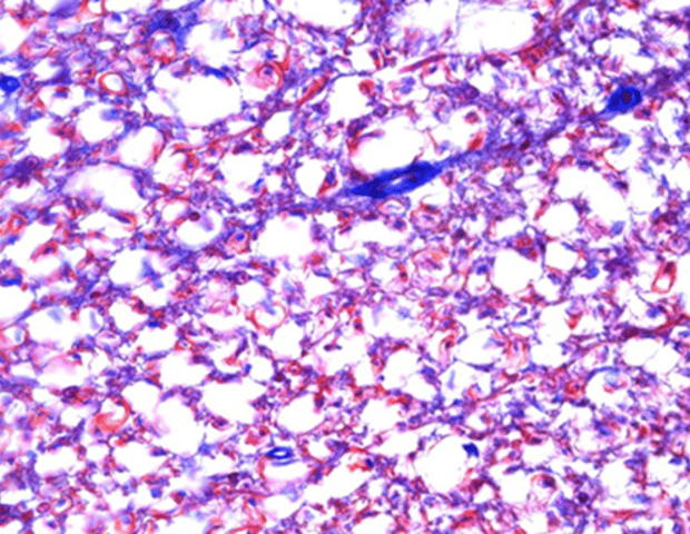 Choosing the right camera for clinical microscopy