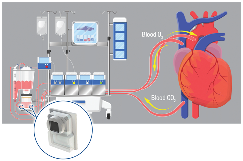 ECMO Machine featuring the BP Series extended range pressure sensor