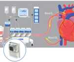 What pressure range do ECMO blood pressure sensors need?