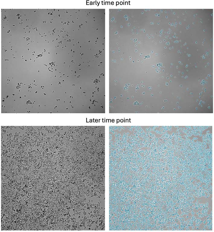 Representative images of HCT-116 cells acquired using the CellXpress.ai system and analyzed with the IN Carta software. Cell segmentation, performed with the Custom Module Editor protocol named “4X TL HCT116 Confluence fast,” is overlaid in blue. Early timepoint shows sparse cell distribution, which increases over time until cell density (later timepoint) reaches the threshold that triggers automated passaging