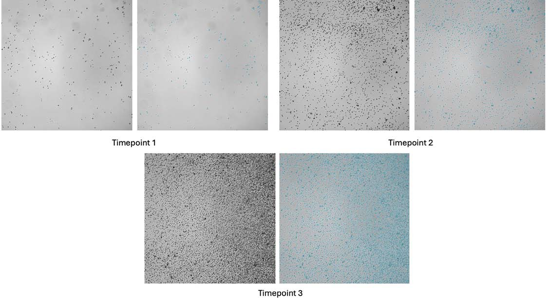 Representative images of CHO cells acquired using the CellXpress.ai system and analyzed with the IN Carta software. Cell segmentation, performed with the Custom Module Editor protocol named “,” is overlaid in blue. Early timepoints show sparse cell distribution, which increases over time until the covered area reaches the threshold that triggers automated passaging.