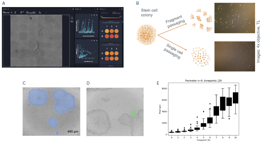 Automated stem cell culture. (A) The CellXpress.ai system user software showing stem cell cultivation workflow. (B) Different passaging methods built into the CellXpress.ai system. (C, D) Deep learning for colony segmentation to discriminate between healthy colonies (C) and differentiated cells (D). (E) Quantification of colony growth monitored over 6 days. Boxplots show the average of 9 plates