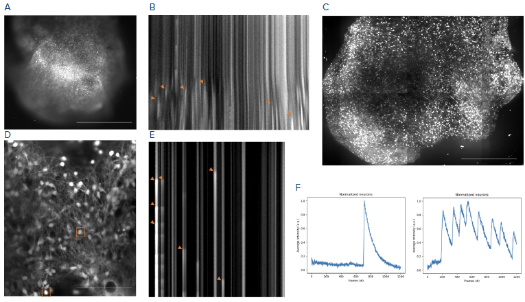 Image acquisition and analysis. (A) Stream acquisition of a calcium-stained brain organoid. (B) Kymograph of A indicating calcium activity. (C) Max projection of high-resolution Z-stack of organoid A. (D) High-resolution stream acquisition of neuronal network of organoid in C. (E) Kymograph of neuronal network of D. (F) Single neuronal traces of D, neurons are indicated by orange boxes. A, B: 4x objective build in the CellXpress.ai system’s automated microscope, 70 ms framerate. C–E: The ImageXpress HT.ai system 20x water immersion. D-F: Step-size 2 μm, frame rate 20 ms. Scale bar A, C = 1 mm, D = 10 μm.