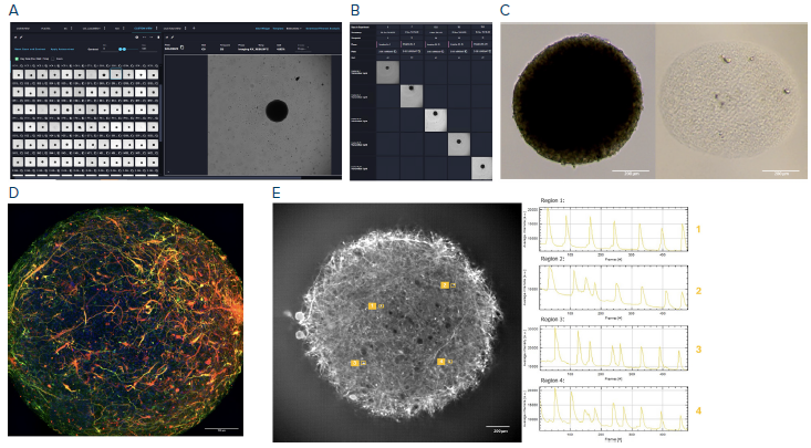Midbrain generation on the CellXpress.ai system. (A) User software showing midbrain organoids cultivated on the CellXpress.ai system. (B) Cell journey to follow individual organoids over time. (C) Pre and post-clearing images. (D) Maximum projection of a whole-mount stain of a cleared midbrain organoid. (E) Stream acquisition of a calcium-stained midbrain, including single neuronal traces for four regions (1–4). A, B: The CellXpress.ai system’s built-in microscope, 4x air objective. C: Evos XL 10x air objective, D, E: The ImageXpress HT.ai system 20x water immersion objective