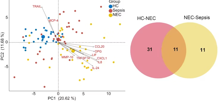 Principal component analysis based on protein levels observed in NEC, sepsis, and HC groups. Wayne diagram highlighting the common and unique proteins in NEC and sepsis groups.