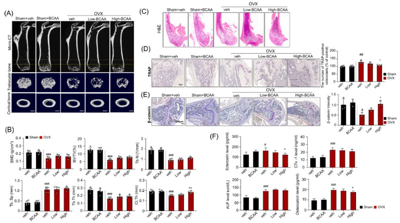 Effects of BCAA on plasma sclerostin, bone turnover markers, bone mineral density, microarchitecture, and osteoclast activity in ovariectomized mice. (A) Representative micro-CT images (top). Two-dimensional reconstruction and 3D-rendered images of different regions (bottom). (B) Bone structural characteristics, including bone mineral density (BMD in g/cm3), ratio of bone volume to total volume (BV/TV in %), and trabecular number (Tb. N in 1/mm2), are shown. (C) Representative H&E-stained femur bone sections. (D) Representative TRAP-stained femur bone (left) and respective quantification analysis of the TRAP-positive osteoclasts (right). (E) Representative images and quantification of β-catenin expression. (F) Measurement of serum levels of sclerostin, CTx-1, ALP, and osteocalcin. Data is shown as mean ± SD, n = 5 (B), n = 4 (D), n = 3 (E), n = 8 animals/group (F). (#p < 0.05, ##p < 0.01, ###p < 0.001 vs. Sham + veh; *p < 0.05, **p < 0.01, ***p < 0.001 vs. OVX + veh).