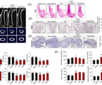 Exploring BCAA supplementation in osteosarcopenia research