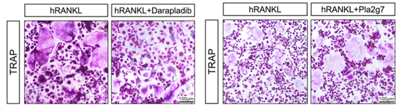 Human PBMCs were stimulated with recombinant human RANKL and M-CSF to induce osteoclast differentiation. Representative TRAP staining images show the formation of multinucleated osteoclasts under RANKL-induced conditions