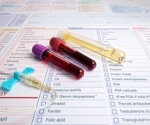 Transforming biological insights with untargeted metabolomics