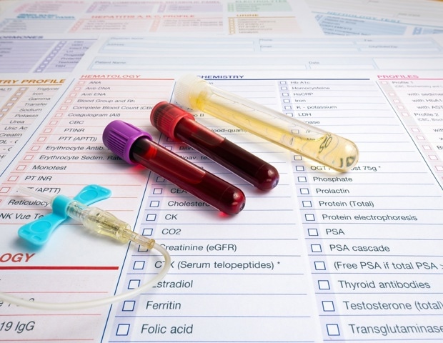 Transforming biological insights with untargeted metabolomics