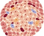 Immune-shielded iPSC islet cells for diabetes