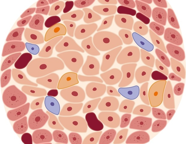 Immune-shielded iPSC islet cells for diabetes
