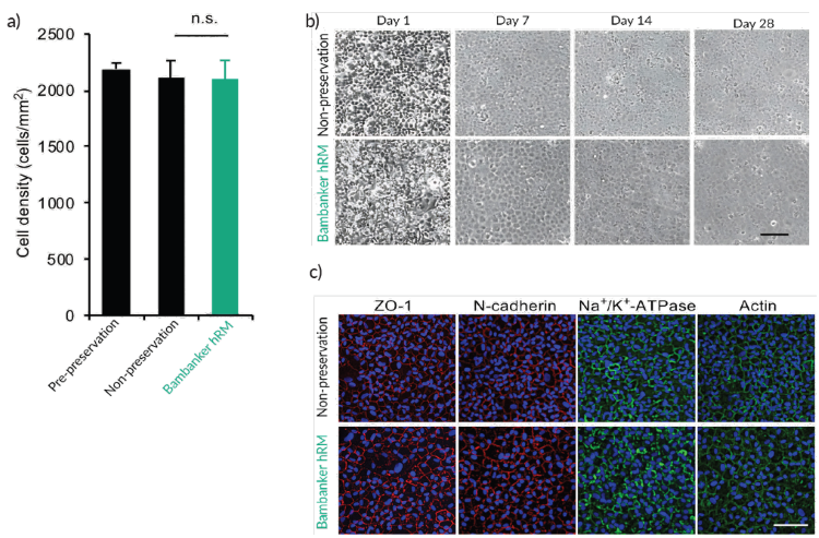 Post-thaw recovery of cultured human corneal endothelial cells cryopreserved with Bambanker™ hRM. a) Cell density after 28 days of culture was comparable between pre-preservation cells, non-preserved control cells, and cells cryopreserved with Bambanker™. The difference between non-preserved control cells and Bambanker™-preserved cells was not statistically significant. b) Phase-contrast images show that Bambanker™-preserved cells recovered over time in culture and formed a monolayer with morphology comparable to nonpreserved control cells by day 28. c) Immunostaining showed that Bambanker™-preserved cells retained key human corneal endothelial cell markers, including ZO-1, N-cadherin, and Na+/K+- ATPase, with actin staining also shown. n.s. indicates no statistically significant difference