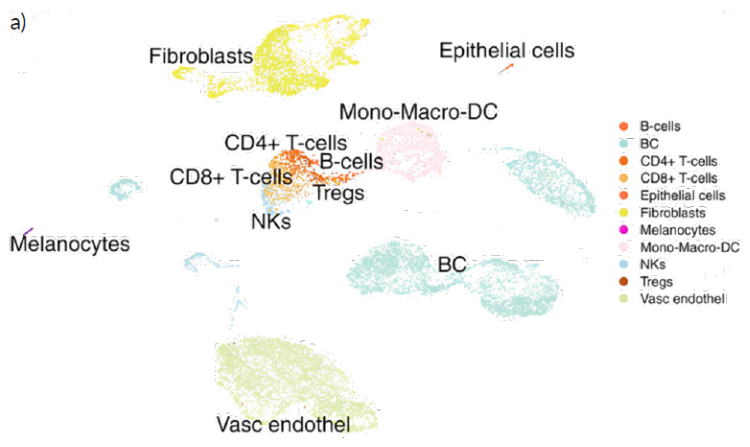 Single-cell profiling of patient-derived breast cancer tissue after slow-freezing in Bambanker™. a) Single-cell clustering identified multiple cell populations, including breast cancer cells, fibroblasts, immune cell subsets, epithelial cells, endothelial cells, melanocytes, and other stromal or immune populations. b) Marker-expression analysis showed breast cancer-relevant gene-expression patterns across recovered breast cancer cell populations. Together, these panels illustrate that Bambanker™-preserved patient-derived tissue could support downstream single-cell cellular profiling after thawing