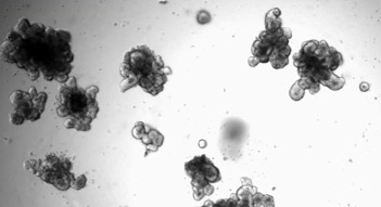 Organoids imaged using transmitted light (TL).
